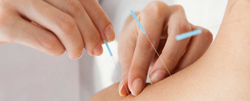 OC Acupuncture Treatment Center cover
