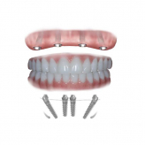 Digital dental implants logo
